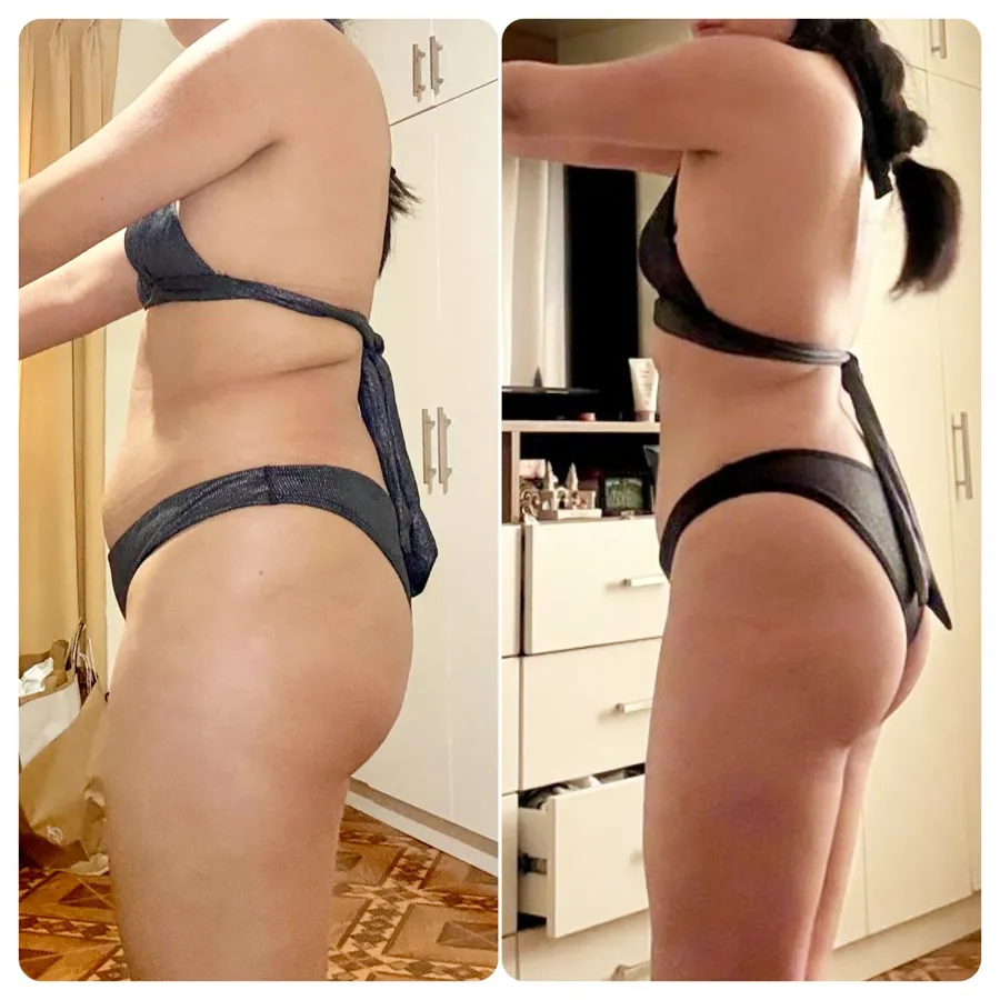 Antes y después real